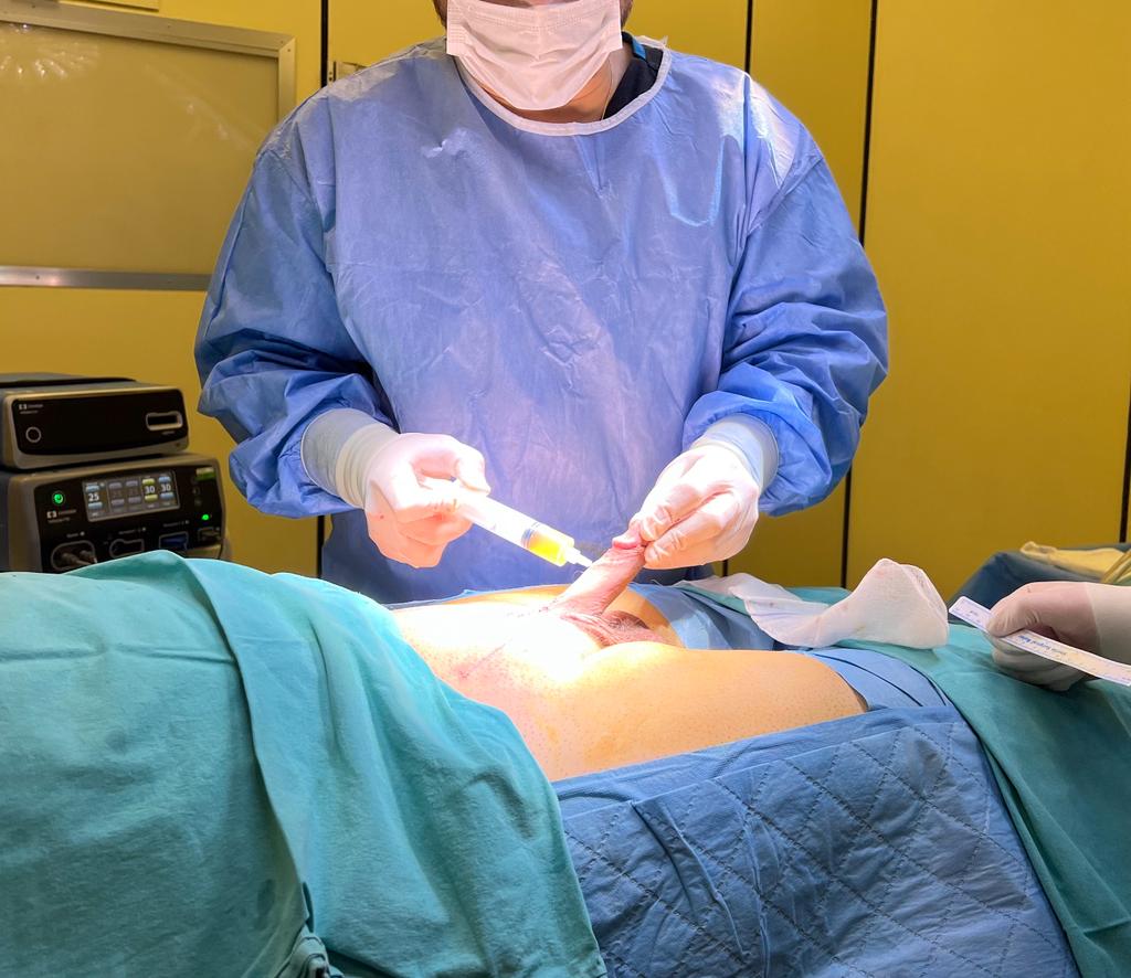 Male enlargement injections
